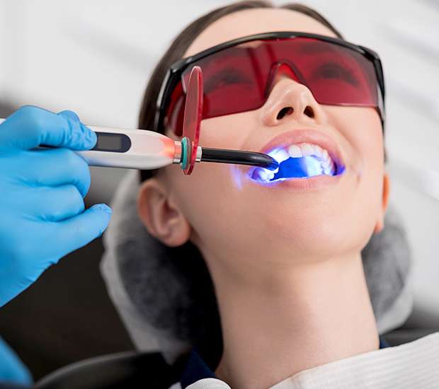 Ann Arbor Professional Teeth Whitening