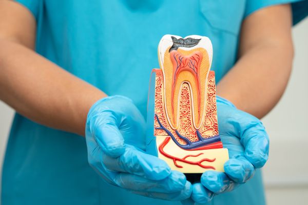 Common Concerns After Getting A Root Canal